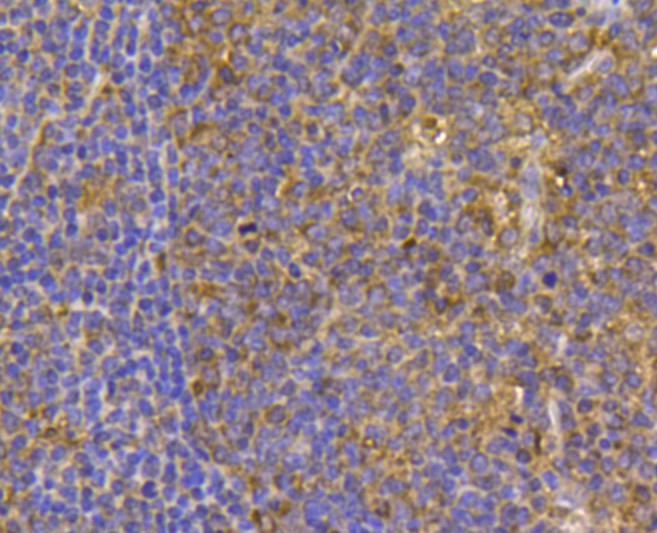 Immunohistochemical analysis of paraffin- embedded human tonsil tissue using anti-HIF-1 alpha rabbit polyclonal antibody.  .