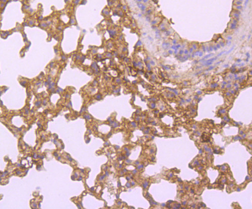 HLA Class 1 ABC Rabbit polyclonal Antibody