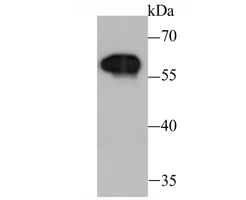Western blot analysis of Tyrosine Hydroxylase on PC-12 cell lysate using anti-Tyrosine Hydroxylase antibody at 1/1,000 dilution.