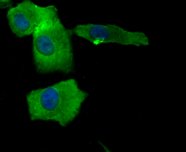 ICC staining BAX in A549 cells (green). The nuclear counter stain is DAPI (blue). Cells were fixed in paraformaldehyde, permeabilised with 0.25% Triton X100/PBS.