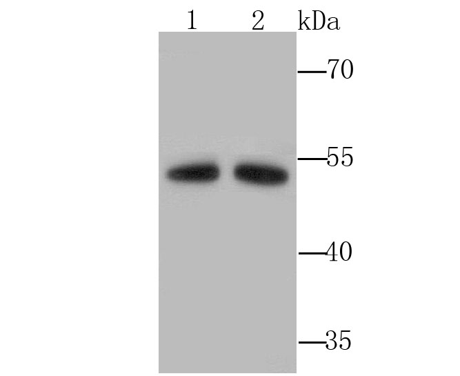 Western blot analysis of Aldh1A1 on 2 liver (1) and 2 kidney (2) tissue lysates using anti-Aldh1A1 antibody at 1/1,000 dilution.
