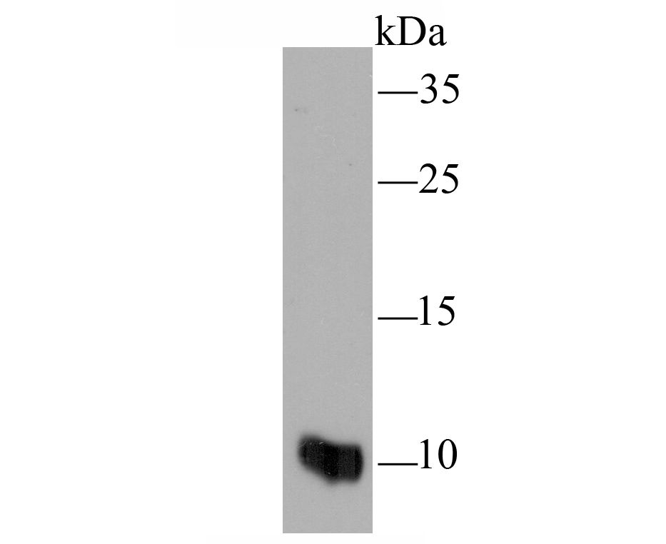 Western blot analysis of MRP8/S100A8 on HL-60 cell lysate using anti-MRP8/S100A8 antibody at 1/100 dilution.