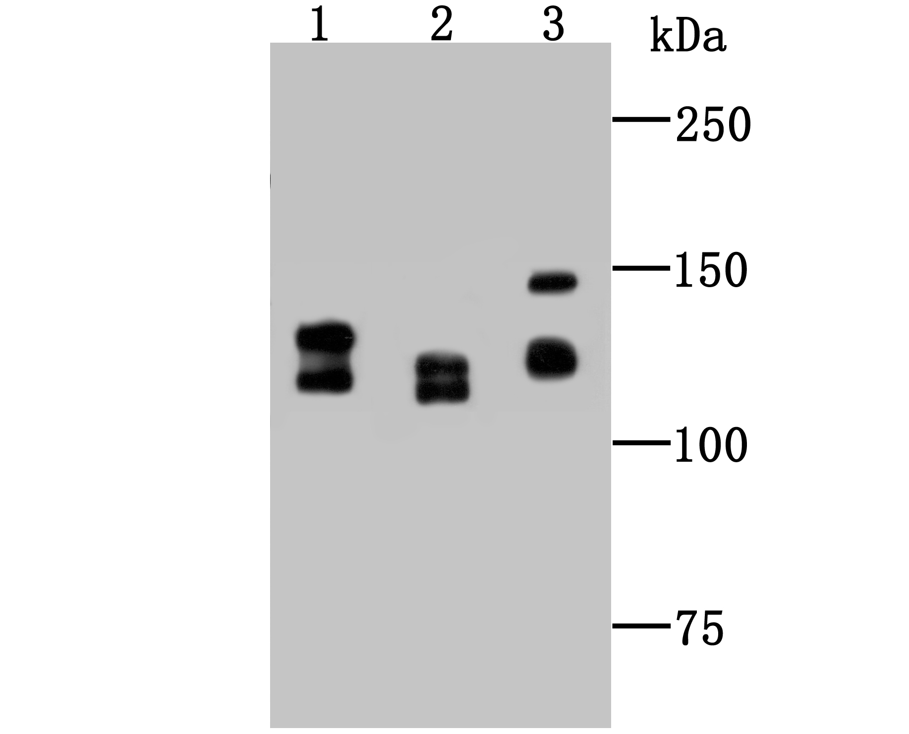 Western blot analysis of DDB1 on different cell lysate using anti-DDB1 antibody at 1/1,000 dilution. Positive control: Lane 1: Mouse colon tissue Lane 2: PC-12 Lane 3: Siha