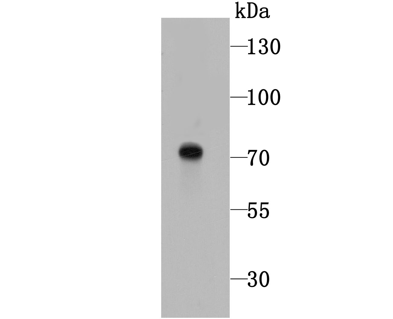 Western blot analysis of Tyrosinase on B16F1 cell lysates using anti- Tyrosinase antibody at 1/1,000 dilution.
