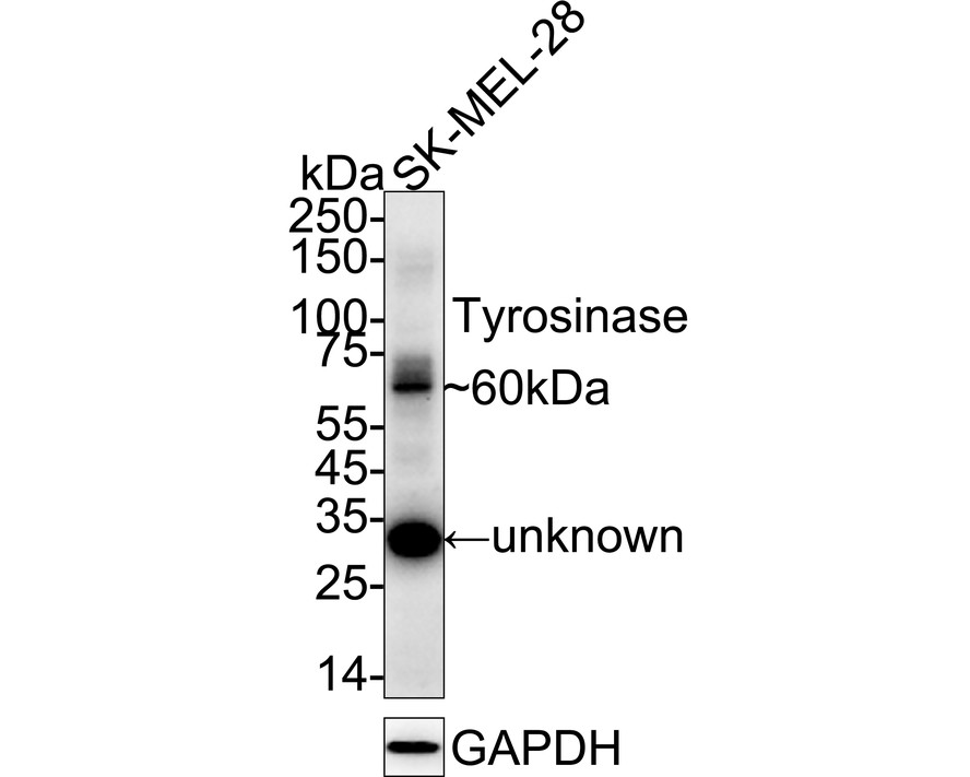 Western blot analysis of Tyrosinase on B16F1 cell lysates using anti- Tyrosinase antibody at 1/1,000 dilution.