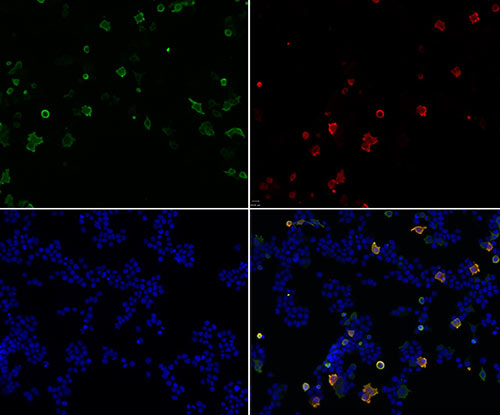ICC staining Retrovirus-related Gag in Retrovirus-related Gag transfected 293 cells (red) and HA-tag staining (green). The nuclear counter stain is DAPI (blue). Cells were fixed in paraformaldehyde, permeabilised with 0.25% Triton X100/PBS.