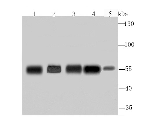 Western blot analysis of G6PD on different lysates using anti-G6PD antibody at 1/1,000 dilution. Positive control: Lane 1: A549 Lane 2: Hela Lane 3: MCF-7 Lane 4: PC-12 Lane 5: Mouse spleen