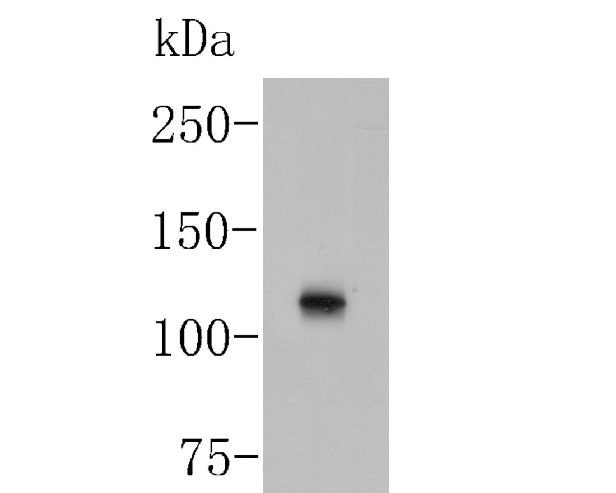 Western blot analysis of Meckelin on MCF-7 cell lysate. Proteins were transferred to a PVDF membrane and blocked with 5% BSA in PBS for 1 hour at room temperature. The primary antibody (0903-7, 1/500) was used in 5% BSA at room temperature for 2 hours. Goat Anti-Rabbit IgG - HRP Secondary Antibody (HA1001) at 1:5,000 dilution was used for 1 hour at room temperature.
