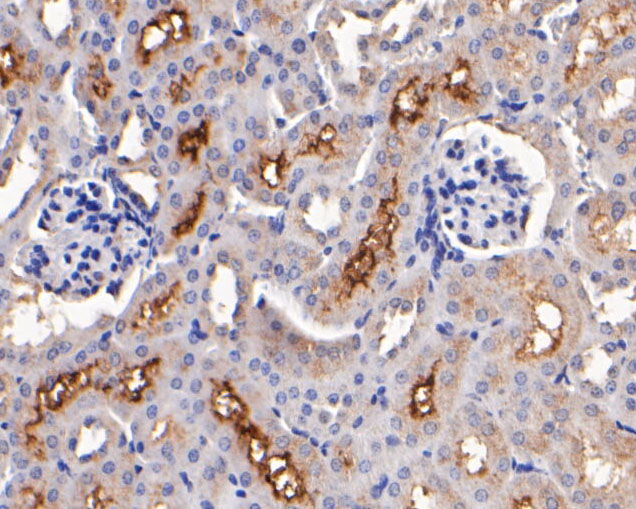 Immunohistochemical analysis of paraffin-embedded mouse kidney tissue using anti-Meckelin antibody. The section was pre-treated using heat mediated antigen retrieval with Tris-EDTA buffer (pH 8.0-8.4) for 20 minutes.The tissues were blocked in 5% BSA for 30 minutes at room temperature, washed with ddH2O and PBS, and then probed with the primary antibody (0903-7, 1/100) for 30 minutes at room temperature. The detection was performed using an HRP conjugated compact polymer system. DAB was used as the chromogen. Tissues were counterstained with hematoxylin and mounted with DPX.