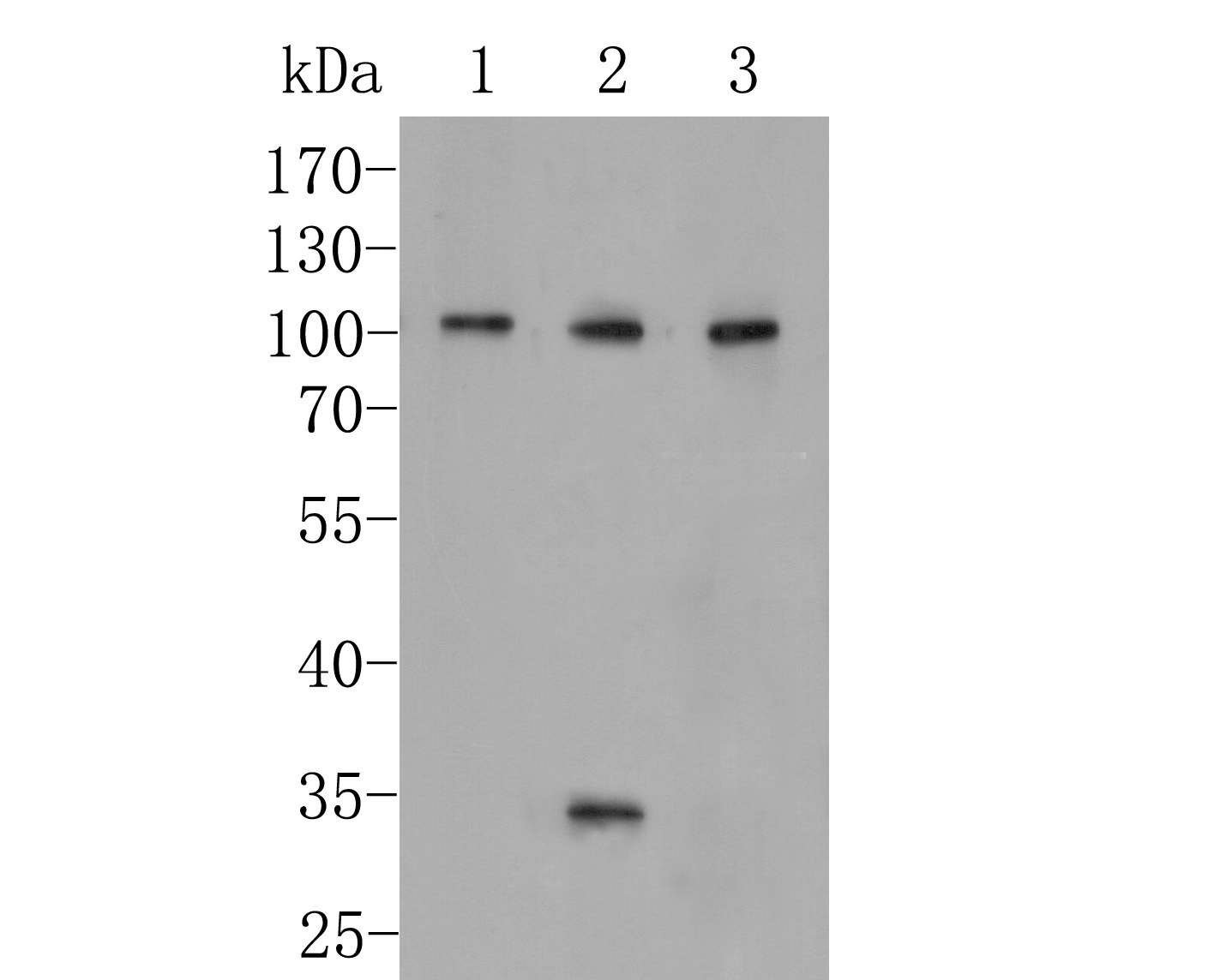ICC staining of CD166 in A431 cells (green). Formalin fixed cells were permeabilized with 0.1% Triton X-100 in TBS for 10 minutes at room temperature and blocked with 1% Blocker BSA for 15 minutes at room temperature. Cells were probed with the primary antibody (EM1902-36, 1/100) for 1 hour at room temperature, washed with PBS. Alexa Fluor®488 Goat anti-Rabbit IgG was used as the secondary antibody at 1/100 dilution. The nuclear counter stain is DAPI (blue).