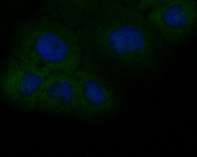 ICC staining of CD166 in Huvec cells (green). Formalin fixed cells were permeabilized with 0.1% Triton X-100 in TBS for 10 minutes at room temperature and blocked with 1% Blocker BSA for 15 minutes at room temperature. Cells were probed with the primary antibody (EM1902-36, 1/100) for 1 hour at room temperature, washed with PBS. Alexa Fluor®488 Goat anti-Mouse IgG was used as the secondary antibody at 1/100 dilution. The nuclear counter stain is DAPI (blue).