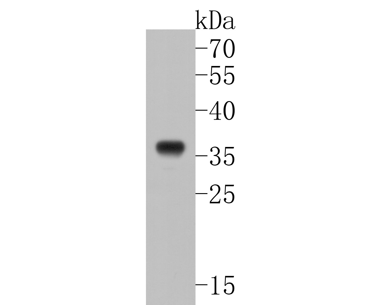 Western blot analysis of Myc-tag on N-terminal Myc-tagged recombinant protein lysates. Proteins were transferred to a PVDF membrane and blocked with 5% BSA in PBS for 1 hour at room temperature. The primary antibody (EM1902-38, 1/5,000) was used in 5% BSA at room temperature for 2 hours. Goat Anti-Rabbit IgG - HRP Secondary Antibody (HA1006) at 1:20,000 dilution was used for 1 hour at room temperature.