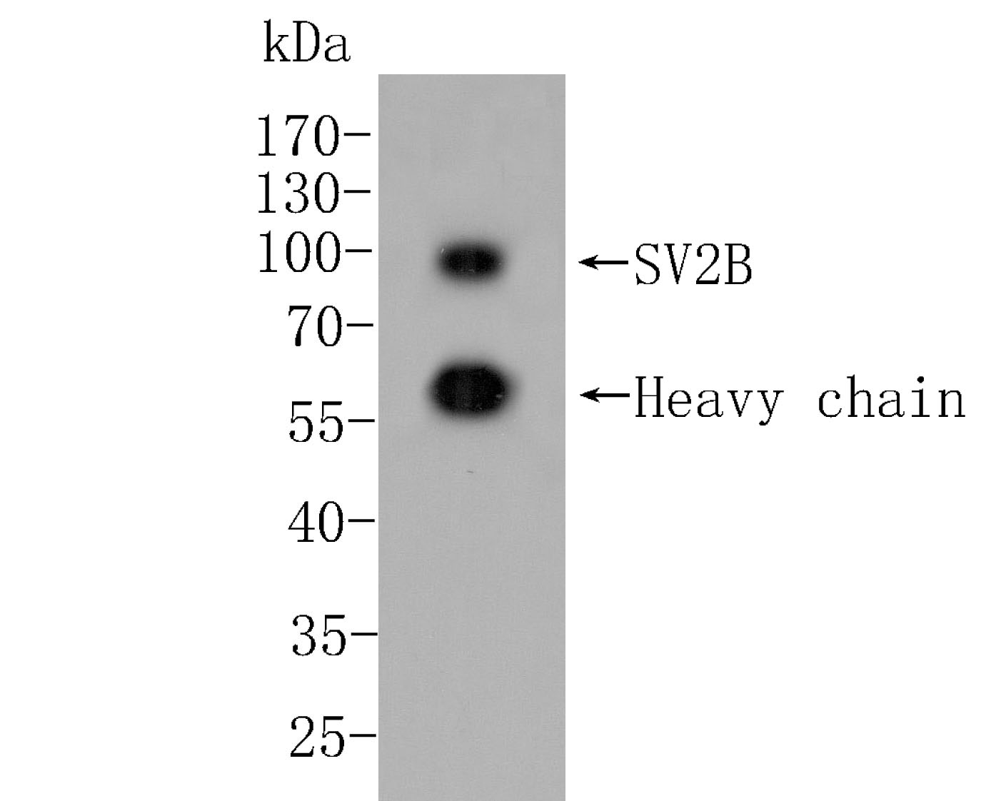 Western blot analysis of SV2B on rat brain tissue lysate. Proteins were transferred to a PVDF membrane and blocked with 5% BSA in PBS for 1 hour at room temperature. The primary antibody (EM1902-40, 1/500) was used in 5% BSA at room temperature for 2 hours. Goat Anti-Mouse IgG - HRP Secondary Antibody (HA1006) at 1:5,000 dilution was used for 1 hour at room temperature.