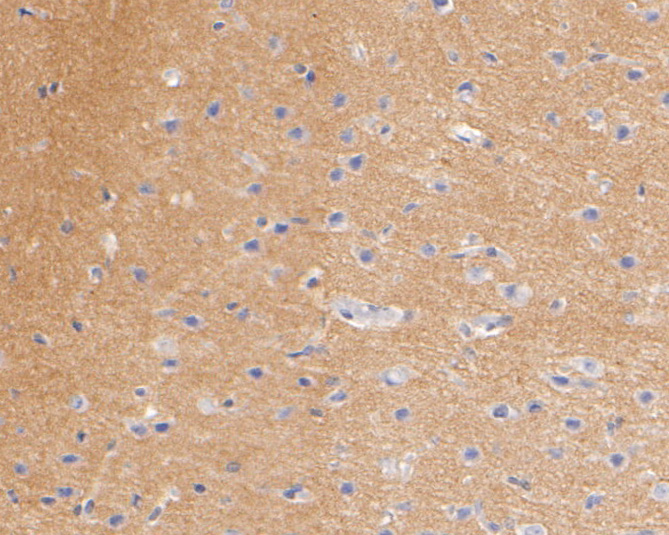 Immunohistochemical analysis of paraffin-embedded rat brain tissue using anti-SV2B antibody. The section was pre-treated using heat mediated antigen retrieval with Tris-EDTA buffer (pH 8.0-8.4) for 20 minutes.The tissues were blocked in 5% BSA for 30 minutes at room temperature, washed with ddH2O and PBS, and then probed with the primary antibody (EM1902-40, 1/100) for 30 minutes at room temperature. The detection was performed using an HRP conjugated compact polymer system. DAB was used as the chromogen. Tissues were counterstained with hematoxylin and mounted with DPX.