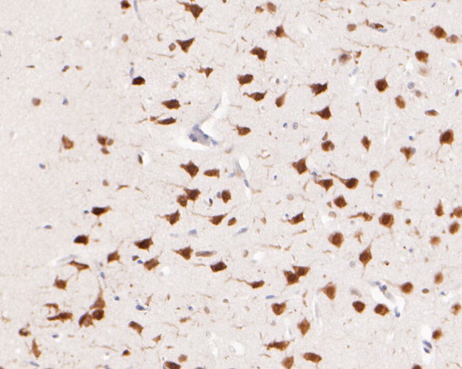 Immunohistochemical analysis of paraffin-embedded rat brain tissue using anti-CELF2 antibody. The section was pre-treated using heat mediated antigen retrieval with sodium citrate buffer (pH 6.0) for 20 minutes. The tissues were blocked in 5% BSA for 30 minutes at room temperature, washed with ddH2O and PBS, and then probed with the primary antibody (EM1902-41, 1/400)  for 30 minutes at room temperature. The detection was performed using an HRP conjugated compact polymer system. DAB was used as the chromogen. Tissues were counterstained with hematoxylin and mounted with DPX.