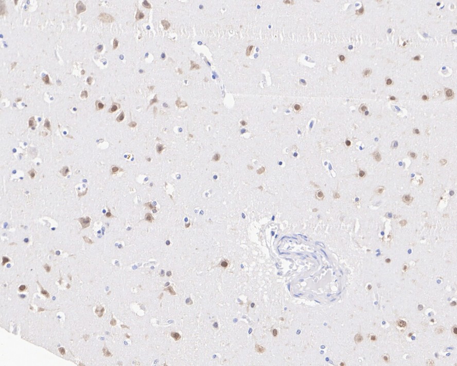 Immunohistochemical analysis of paraffin-embedded mouse colon tissue using anti-CELF2 antibody. The section was pre-treated using heat mediated antigen retrieval with sodium citrate buffer (pH 6.0) for 20 minutes. The tissues were blocked in 5% BSA for 30 minutes at room temperature, washed with ddH2O and PBS, and then probed with the primary antibody (EM1902-43, 1/400)  for 30 minutes at room temperature. The detection was performed using an HRP conjugated compact polymer system. DAB was used as the chromogen. Tissues were counterstained with hematoxylin and mounted with DPX.