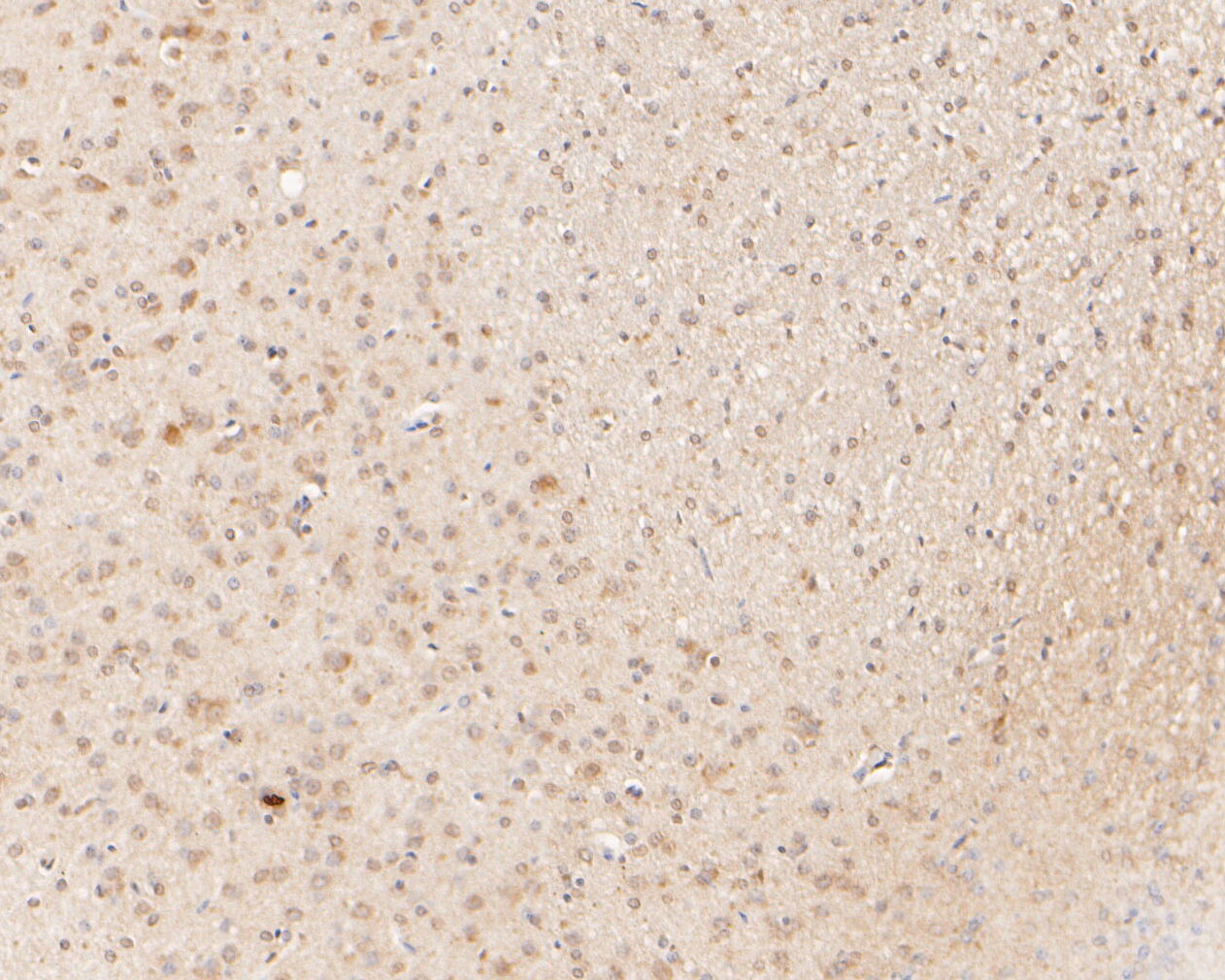 Immunohistochemical analysis of paraffin-embedded rat brain tissue using anti-CPEB1 antibody. The section was pre-treated using heat mediated antigen retrieval with sodium citrate buffer (pH 6.0) for 20 minutes. The tissues were blocked in 5% BSA for 30 minutes at room temperature, washed with ddH2O and PBS, and then probed with the primary antibody (ER1902-89, 1/200)  for 30 minutes at room temperature. The detection was performed using an HRP conjugated compact polymer system. DAB was used as the chromogen. Tissues were counterstained with hematoxylin and mounted with DPX.
