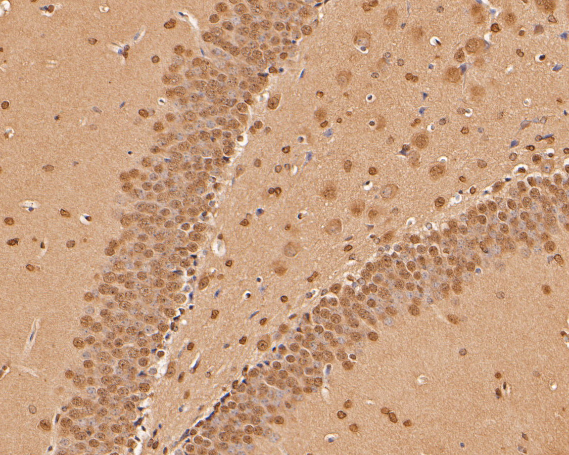 Immunohistochemical analysis of paraffin-embedded mouse brain tissue using anti-CPEB1 antibody. The section was pre-treated using heat mediated antigen retrieval with sodium citrate buffer (pH 6.0) for 20 minutes. The tissues were blocked in 5% BSA for 30 minutes at room temperature, washed with ddH2O and PBS, and then probed with the primary antibody (ER1902-89, 1/200)  for 30 minutes at room temperature. The detection was performed using an HRP conjugated compact polymer system. DAB was used as the chromogen. Tissues were counterstained with hematoxylin and mounted with DPX.