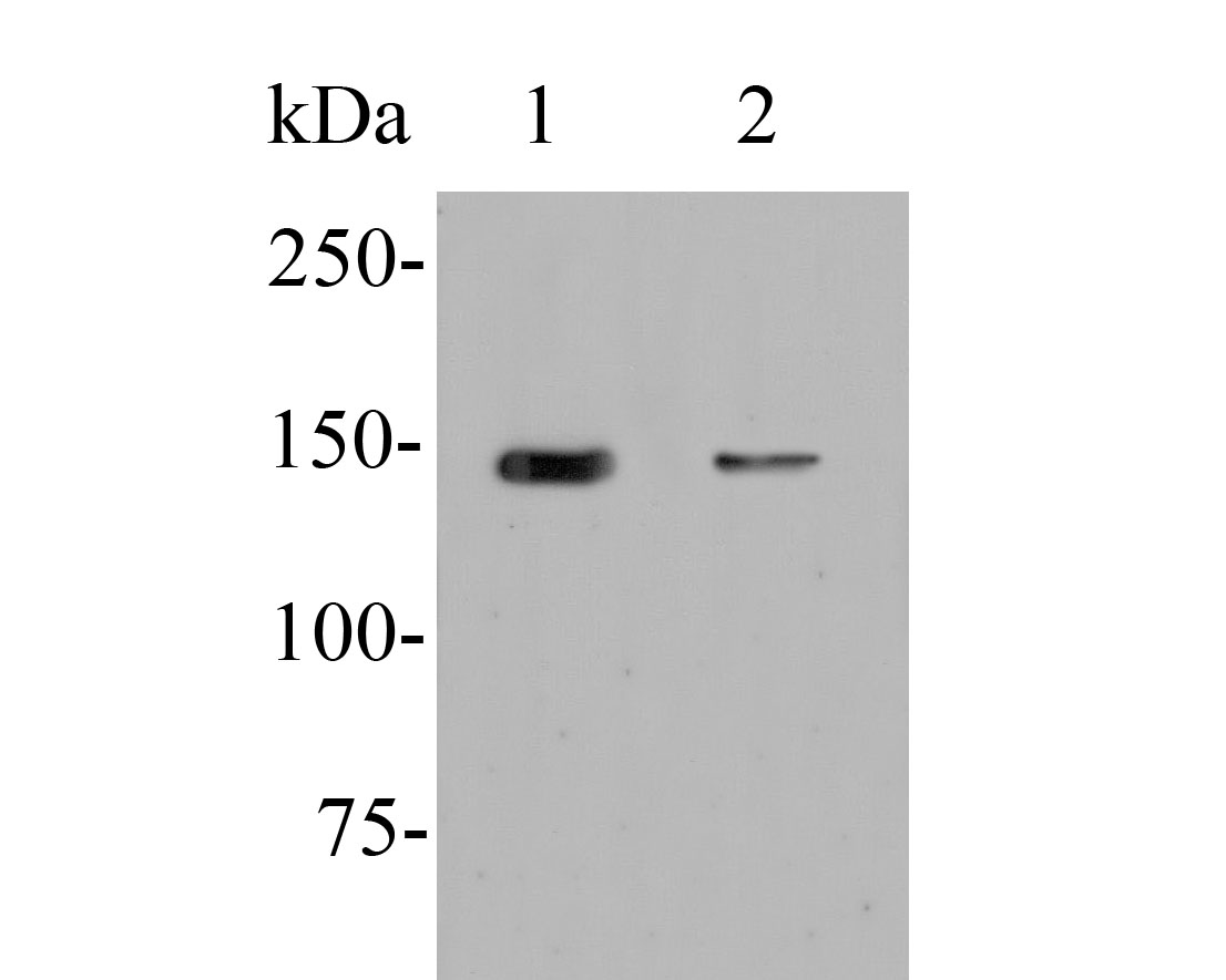 Western blot analysis of ERN1 on different lysates. Proteins were transferred to a PVDF membrane and blocked with 5% BSA in PBS for 1 hour at room temperature. The primary antibody (ER1902-90, 1/500) was used in 5% BSA at room temperature for 2 hours. Goat Anti-Rabbit IgG - HRP Secondary Antibody (HA1001) at 1:5,000 dilution was used for 1 hour at room temperature.<br />
Positive control: <br />
Lane 1: C2C12 cell lysate<br />
Lane 2: HepG2 cell lysate