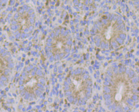 Immunohistochemical analysis of paraffin-embedded human appendix tissue using anti-ERN1 antibody. The section was pre-treated using heat mediated antigen retrieval with Tris-EDTA buffer (pH 8.0-8.4) for 20 minutes.The tissues were blocked in 5% BSA for 30 minutes at room temperature, washed with ddH2O and PBS, and then probed with the primary antibody (ER1902-90, 1/100) for 30 minutes at room temperature. The detection was performed using an HRP conjugated compact polymer system. DAB was used as the chromogen. Tissues were counterstained with hematoxylin and mounted with DPX.