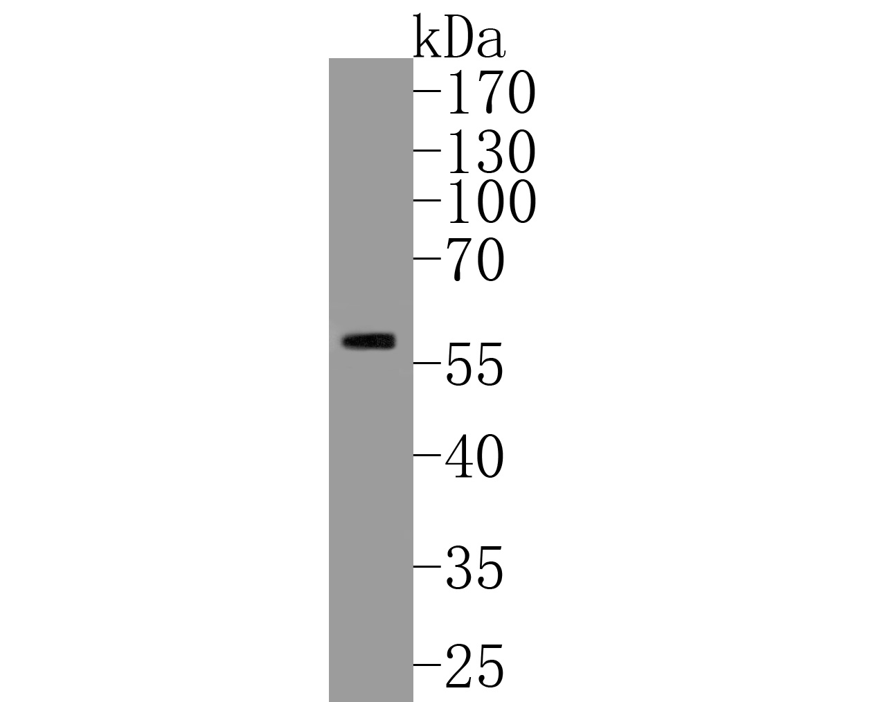 Western blot analysis of CPEB1 on rat skin tissue lysates. Proteins were transferred to a PVDF membrane and blocked with 5% BSA in PBS for 1 hour at room temperature. The primary antibody (ER1902-92, 1/500) was used in 5% BSA at room temperature for 2 hours. Goat Anti-Rabbit IgG - HRP Secondary Antibody (HA1001) at 1:5,000 dilution was used for 1 hour at room temperature.