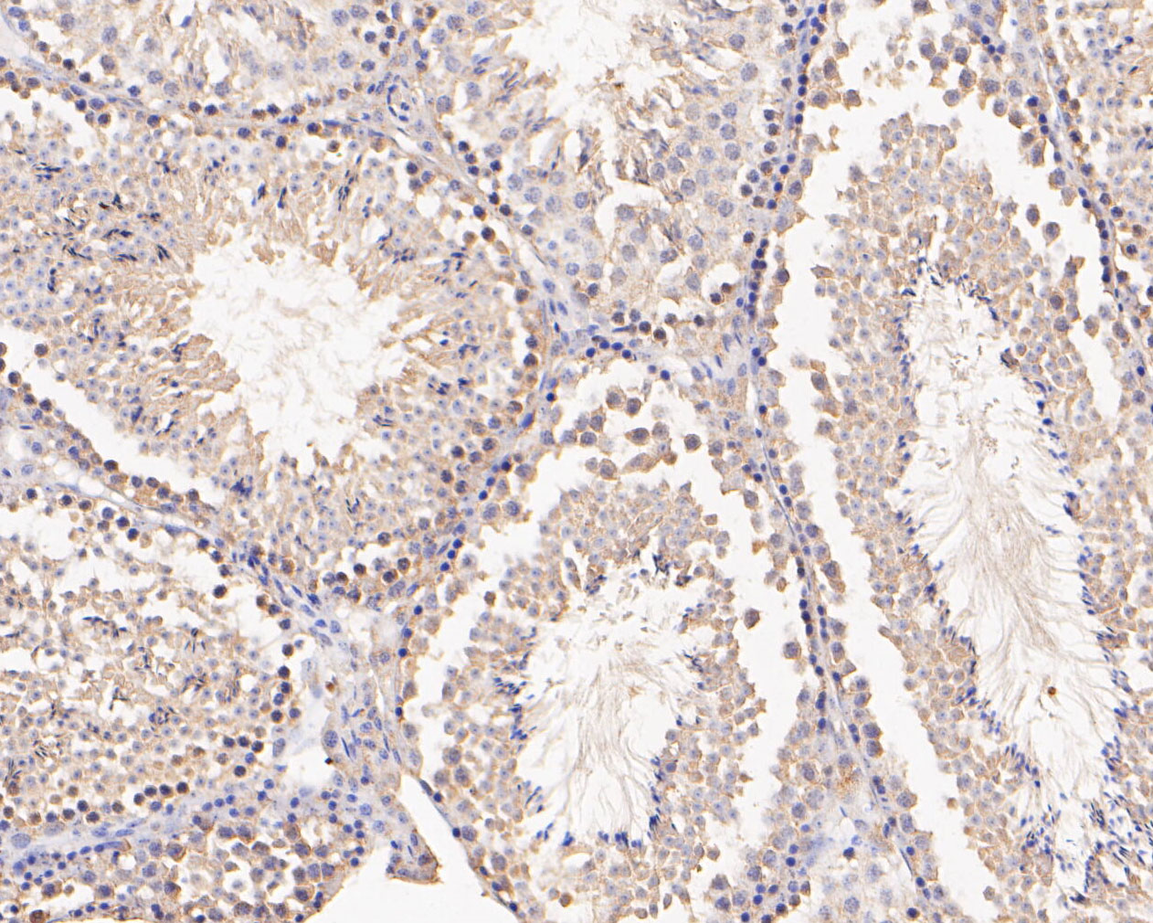 Immunohistochemical analysis of paraffin-embedded mouse testis tissue using anti-MFF antibody. The section was pre-treated using heat mediated antigen retrieval with Tris-EDTA buffer (pH 8.0-8.4) for 20 minutes.The tissues were blocked in 5% BSA for 30 minutes at room temperature, washed with ddH2O and PBS, and then probed with the primary antibody (ER1902-93, 1/50) for 30 minutes at room temperature. The detection was performed using an HRP conjugated compact polymer system. DAB was used as the chromogen. Tissues were counterstained with hematoxylin and mounted with DPX.