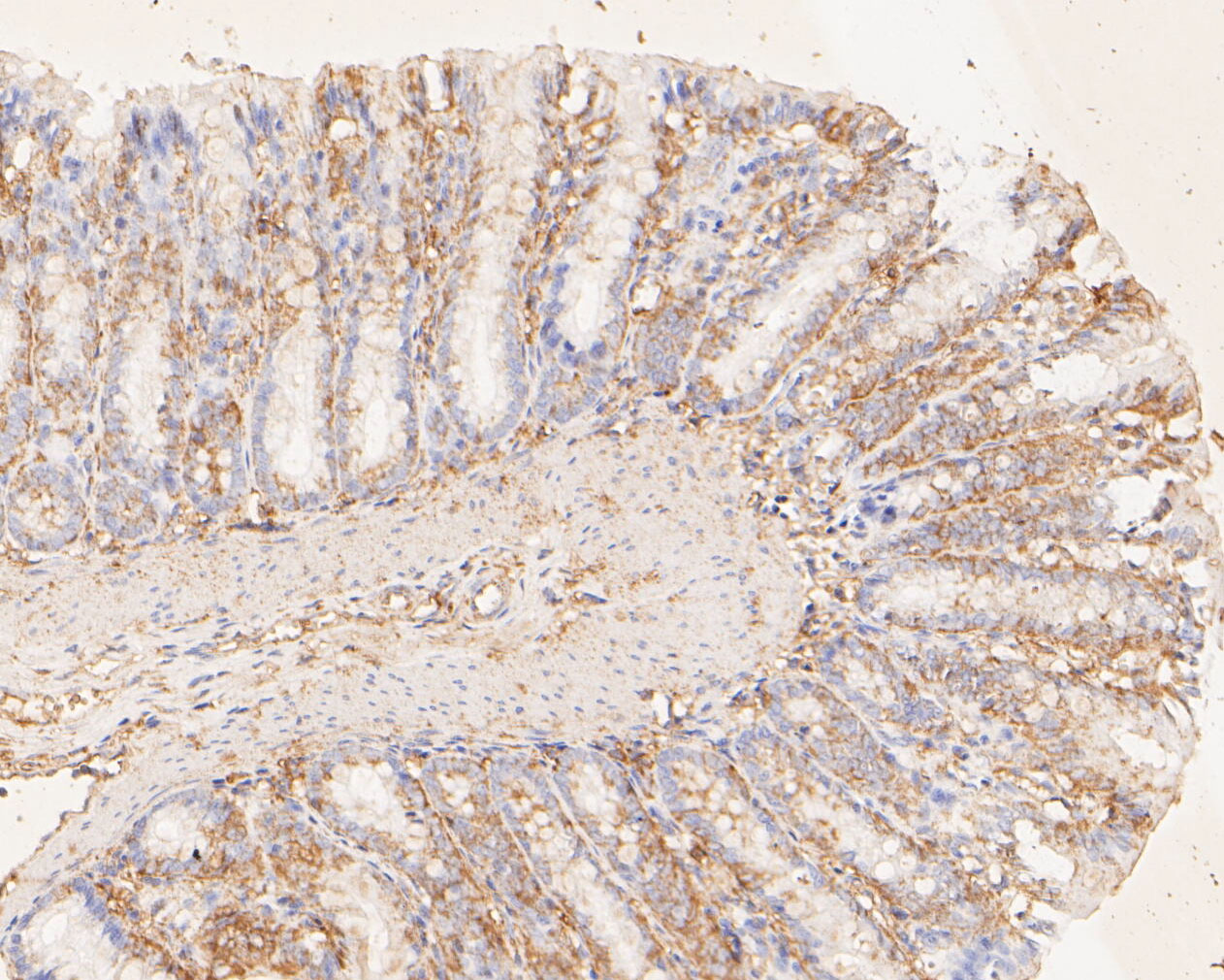 Immunohistochemical analysis of paraffin-embedded rat large intestine tissue using anti-PYCR1 antibody. The section was pre-treated using heat mediated antigen retrieval with Tris-EDTA buffer (pH 8.0-8.4) for 20 minutes.The tissues were blocked in 5% BSA for 30 minutes at room temperature, washed with ddH2O and PBS, and then probed with the primary antibody (ER1902-94, 1/100) for 30 minutes at room temperature. The detection was performed using an HRP conjugated compact polymer system. DAB was used as the chromogen. Tissues were counterstained with hematoxylin and mounted with DPX.