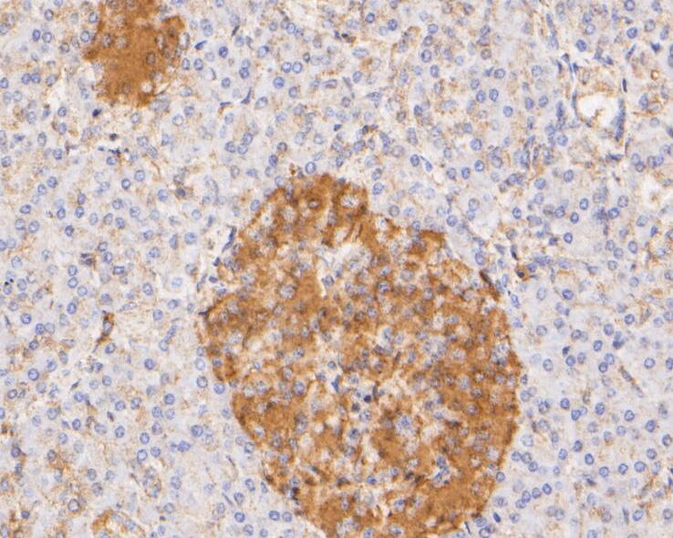 Immunohistochemical analysis of paraffin-embedded human pancreas  tissue using anti-PYCR1 antibody. The section was pre-treated using heat mediated antigen retrieval with Tris-EDTA buffer (pH 8.0-8.4) for 20 minutes.The tissues were blocked in 5% BSA for 30 minutes at room temperature, washed with ddH2O and PBS, and then probed with the primary antibody (ER1902-94, 1/200) for 30 minutes at room temperature. The detection was performed using an HRP conjugated compact polymer system. DAB was used as the chromogen. Tissues were counterstained with hematoxylin and mounted with DPX.