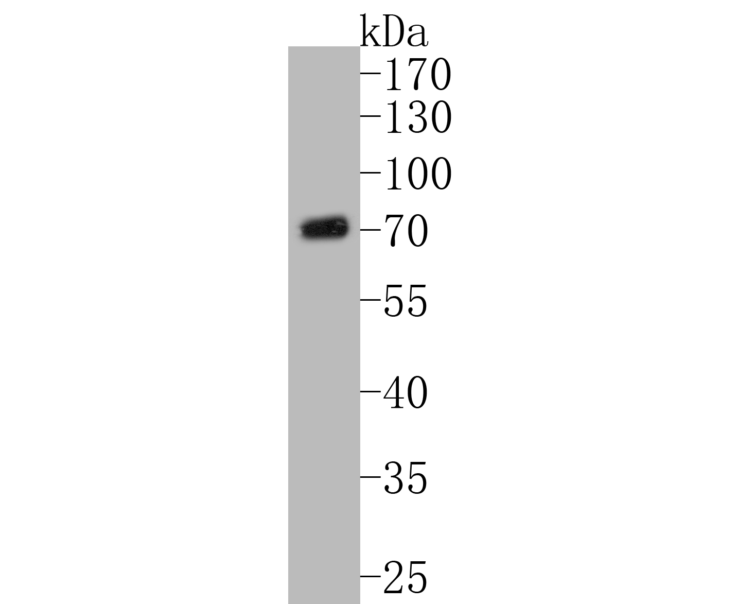 Western blot analysis of CHRNB2 on Jurkat cell lysates. Proteins were transferred to a PVDF membrane and blocked with 5% BSA in PBS for 1 hour at room temperature. The primary antibody (ER1902-95, 1/500) was used in 5% BSA at room temperature for 2 hours. Goat Anti-Rabbit IgG - HRP Secondary Antibody (HA1001) at 1:5,000 dilution was used for 1 hour at room temperature.