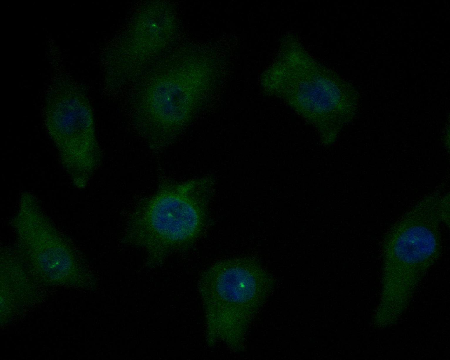 ICC staining of CHRNB2 in A549 cells (green). Formalin fixed cells were permeabilized with 0.1% Triton X-100 in TBS for 10 minutes at room temperature and blocked with 1% Blocker BSA for 15 minutes at room temperature. Cells were probed with the primary antibody (ER1902-95, 1/50) for 1 hour at room temperature, washed with PBS. Alexa Fluor®488 Goat anti-Rabbit IgG was used as the secondary antibody at 1/1,000 dilution. The nuclear counter stain is DAPI (blue).