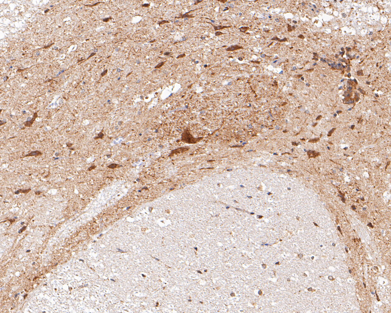 Immunohistochemical analysis of paraffin-embedded rat spinal cord tissue using anti-CHRNB2 antibody. The section was pre-treated using heat mediated antigen retrieval with Tris-EDTA buffer (pH 8.0-8.4) for 20 minutes.The tissues were blocked in 5% BSA for 30 minutes at room temperature, washed with ddH2O and PBS, and then probed with the primary antibody (ER1902-95, 1/200) for 30 minutes at room temperature. The detection was performed using an HRP conjugated compact polymer system. DAB was used as the chromogen. Tissues were counterstained with hematoxylin and mounted with DPX.
