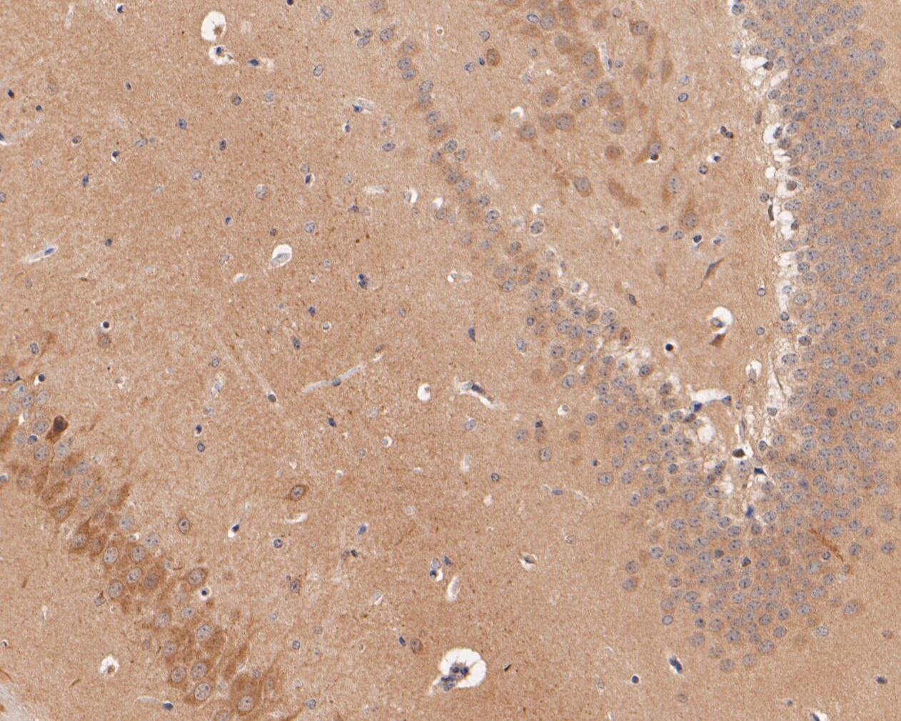 Immunohistochemical analysis of paraffin-embedded mouse brain tissue using anti-CHRNB2 antibody. The section was pre-treated using heat mediated antigen retrieval with Tris-EDTA buffer (pH 8.0-8.4) for 20 minutes.The tissues were blocked in 5% BSA for 30 minutes at room temperature, washed with ddH2O and PBS, and then probed with the primary antibody (ER1902-95, 1/50) for 30 minutes at room temperature. The detection was performed using an HRP conjugated compact polymer system. DAB was used as the chromogen. Tissues were counterstained with hematoxylin and mounted with DPX.