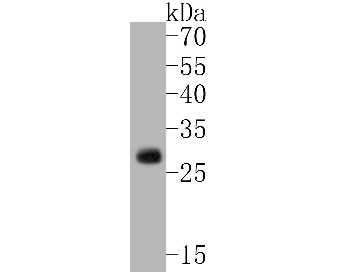 Western blot analysis of TREM2 on mouse brain tissue lysates. Proteins were transferred to a PVDF membrane and blocked with 5% BSA in PBS for 1 hour at room temperature. The primary antibody (ER1902-96, 1/500) was used in 5% BSA at room temperature for 2 hours. Goat Anti-Rabbit IgG - HRP Secondary Antibody (HA1001) at 1:5,000 dilution was used for 1 hour at room temperature.