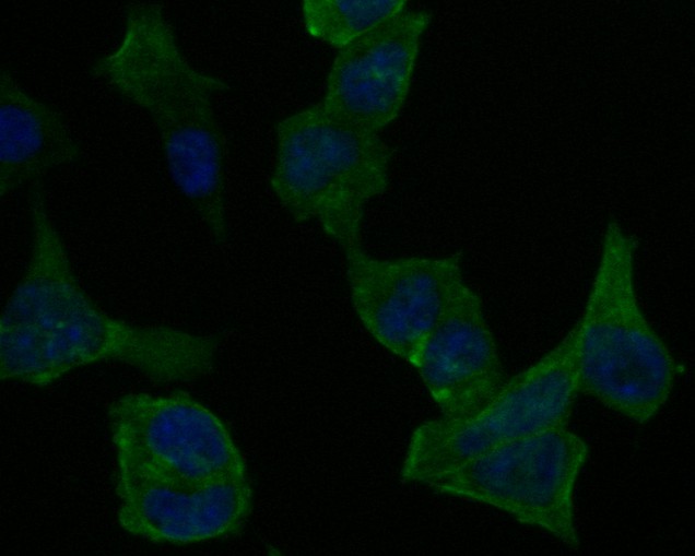 ICC staining of PICK1 in F9 cells (green). Formalin fixed cells were permeabilized with 0.1% Triton X-100 in TBS for 10 minutes at room temperature and blocked with 10% negative goat serum for 15 minutes at room temperature. Cells were probed with the primary antibody (ER1902-97, 1/200) for 1 hour at room temperature, washed with PBS. Alexa Fluor®488 Goat anti-Rabbit IgG was used as the secondary antibody at 1/1,000 dilution. The nuclear counter stain is DAPI (blue).