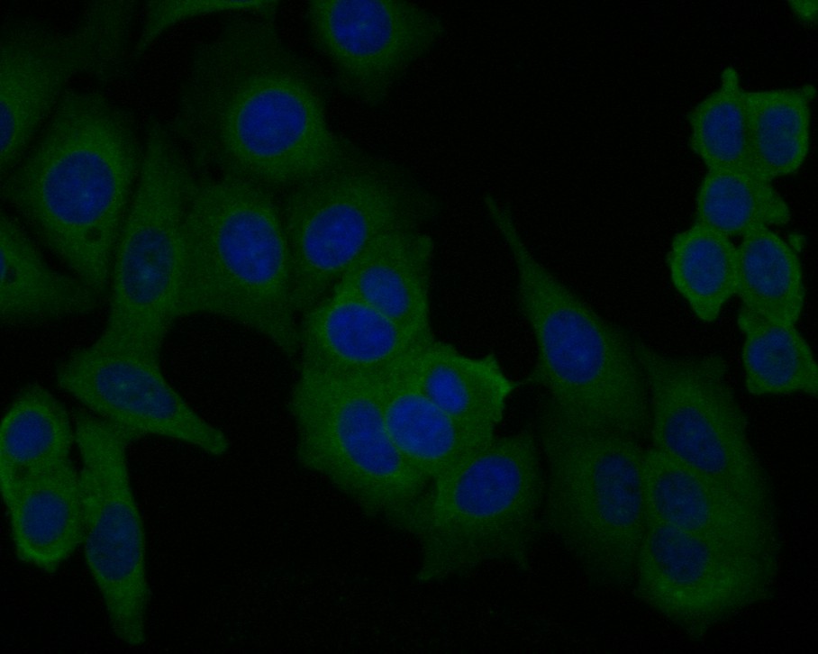 ICC staining of PICK1 in MCF-7 cells (green). Formalin fixed cells were permeabilized with 0.1% Triton X-100 in TBS for 10 minutes at room temperature and blocked with 10% negative goat serum for 15 minutes at room temperature. Cells were probed with the primary antibody (ER1902-97, 1/100) for 1 hour at room temperature, washed with PBS. Alexa Fluor®488 Goat anti-Rabbit IgG was used as the secondary antibody at 1/1,000 dilution. The nuclear counter stain is DAPI (blue).