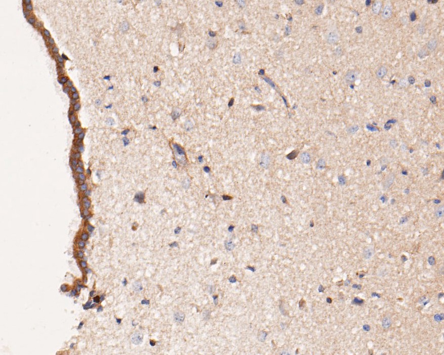 Immunohistochemical analysis of paraffin-embedded rat brain tissue using anti-PICK1 antibody. The section was pre-treated using heat mediated antigen retrieval with Tris-EDTA buffer (pH 9.0) for 20 minutes.The tissues were blocked in 5% BSA for 30 minutes at room temperature, washed with ddH2O and PBS, and then probed with the primary antibody (ER1902-97, 1/50) for 30 minutes at room temperature. The detection was performed using an HRP conjugated compact polymer system. DAB was used as the chromogen. Tissues were counterstained with hematoxylin and mounted with DPX.