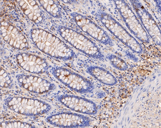 Immunohistochemical analysis of paraffin-embedded human colon tissue using anti-PICK1 antibody. The section was pre-treated using heat mediated antigen retrieval with Tris-EDTA buffer (pH 9.0) for 20 minutes.The tissues were blocked in 5% BSA for 30 minutes at room temperature, washed with ddH2O and PBS, and then probed with the primary antibody (ER1902-97, 1/50) for 30 minutes at room temperature. The detection was performed using an HRP conjugated compact polymer system. DAB was used as the chromogen. Tissues were counterstained with hematoxylin and mounted with DPX.