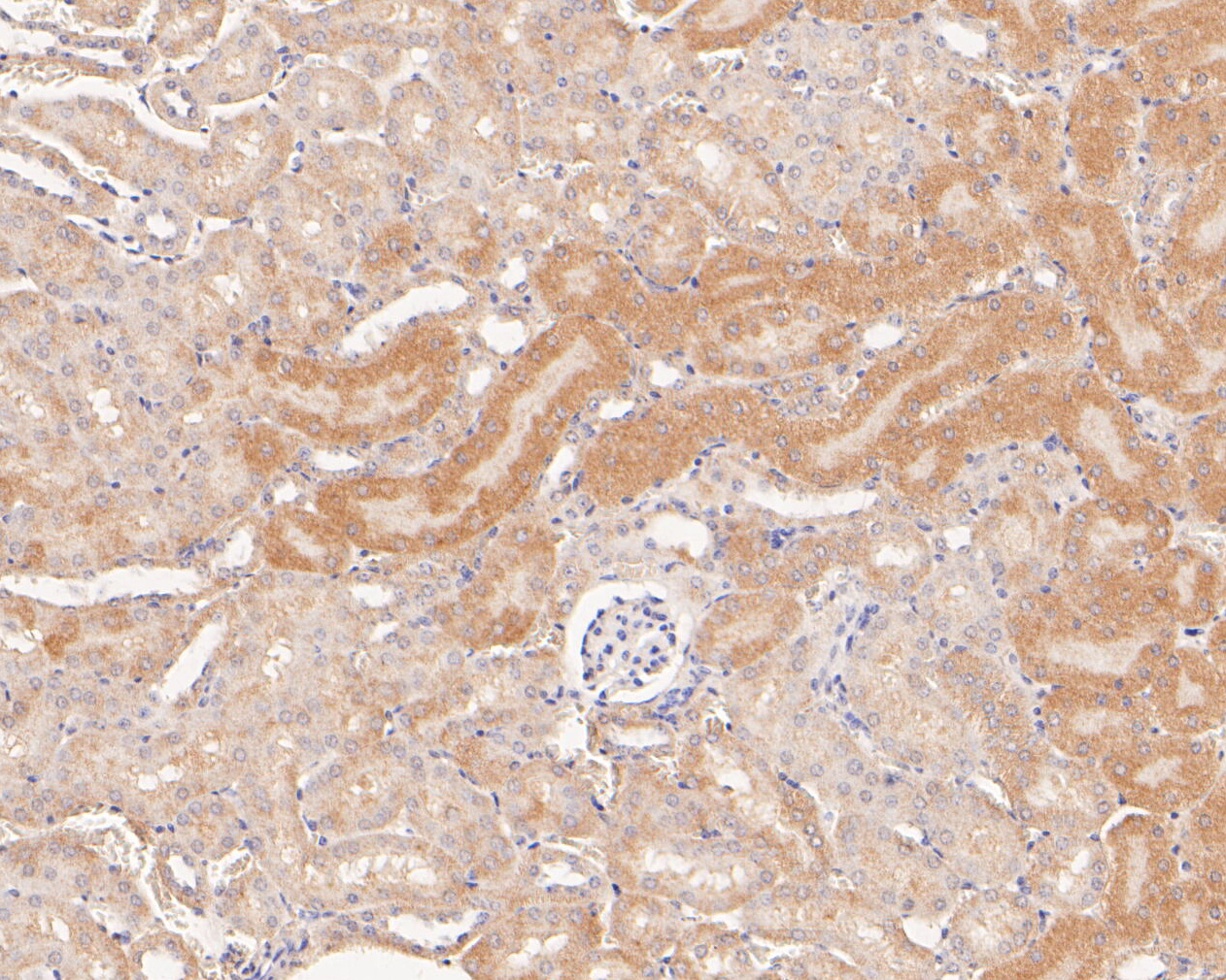 Immunohistochemical analysis of paraffin-embedded mouse kidney tissue using anti-MTHFD2 antibody. The section was pre-treated using heat mediated antigen retrieval with Tris-EDTA buffer (pH 8.0-8.4) for 20 minutes.The tissues were blocked in 5% BSA for 30 minutes at room temperature, washed with ddH2O and PBS, and then probed with the primary antibody (ER1902-98, 1/50) for 30 minutes at room temperature. The detection was performed using an HRP conjugated compact polymer system. DAB was used as the chromogen. Tissues were counterstained with hematoxylin and mounted with DPX.