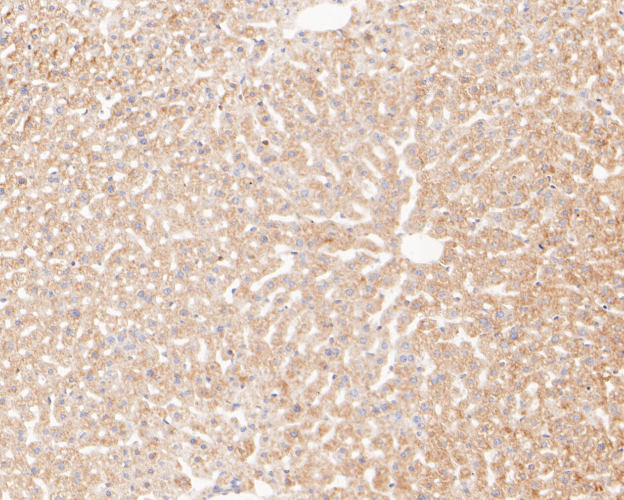 Immunohistochemical analysis of paraffin-embedded mouse liver tissue using anti-MAGT1 antibody. The section was pre-treated using heat mediated antigen retrieval with Tris-EDTA buffer (pH 8.0-8.4) for 20 minutes.The tissues were blocked in 5% BSA for 30 minutes at room temperature, washed with ddH2O and PBS, and then probed with the primary antibody (ER1902-99, 1/200) for 30 minutes at room temperature. The detection was performed using an HRP conjugated compact polymer system. DAB was used as the chromogen. Tissues were counterstained with hematoxylin and mounted with DPX.