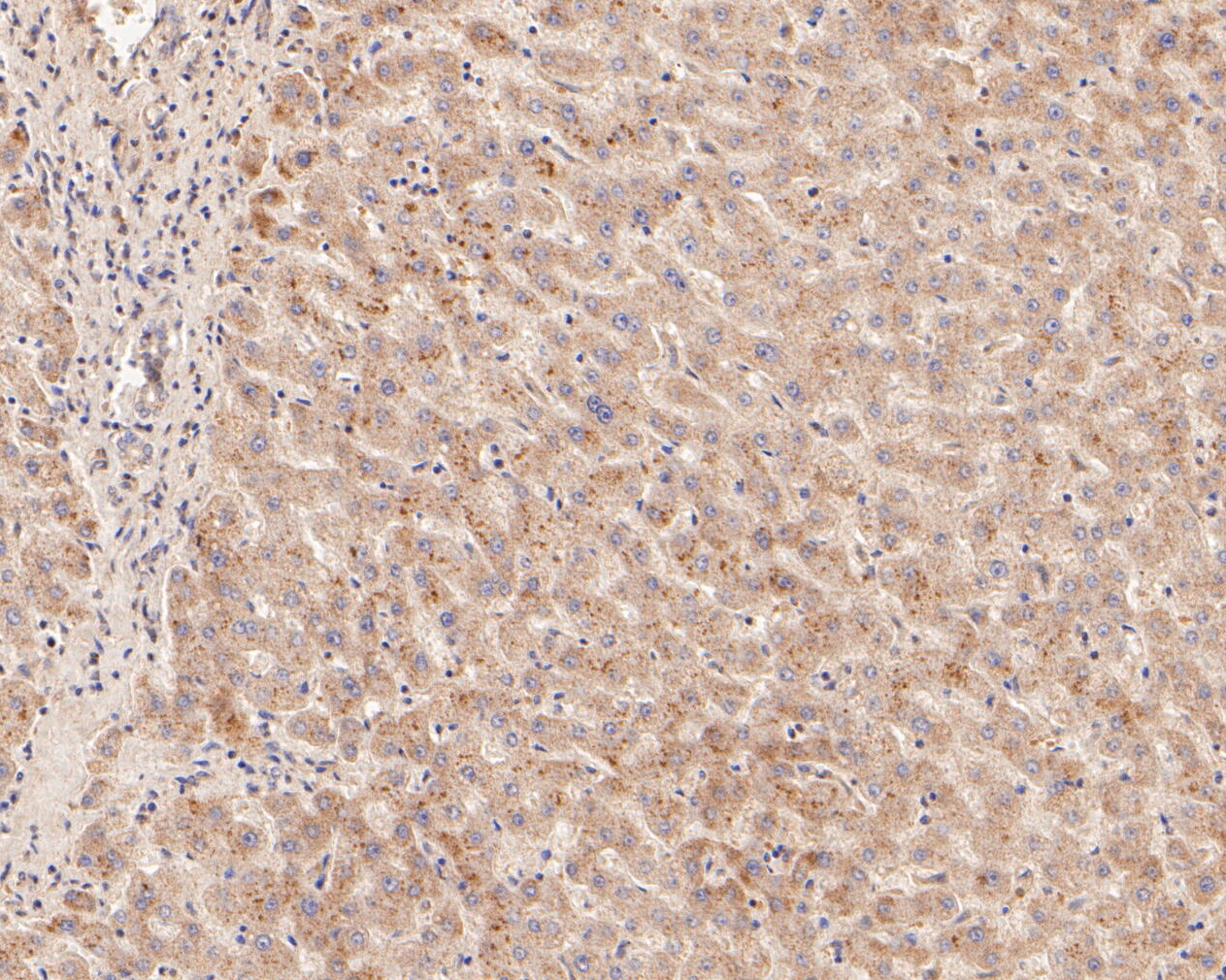 Immunohistochemical analysis of paraffin-embedded human liver tissue using anti-MFF antibody. The section was pre-treated using heat mediated antigen retrieval with Tris-EDTA buffer (pH 8.0-8.4) for 20 minutes.The tissues were blocked in 5% BSA for 30 minutes at room temperature, washed with ddH2O and PBS, and then probed with the primary antibody (ER2001-01, 1/200) for 30 minutes at room temperature. The detection was performed using an HRP conjugated compact polymer system. DAB was used as the chromogen. Tissues were counterstained with hematoxylin and mounted with DPX.