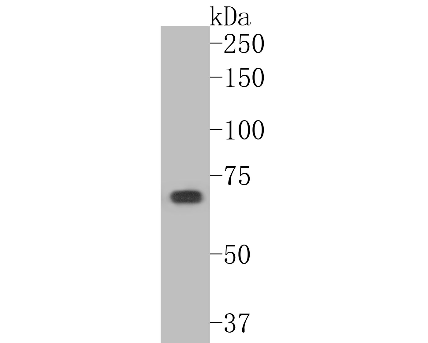 Western blot analysis of Optineurin on A431 cell lysates. Proteins were transferred to a PVDF membrane and blocked with 5% BSA in PBS for 1 hour at room temperature. The primary antibody (ER2001-02, 1/500) was used in 5% BSA at room temperature for 2 hours. Goat Anti-Rabbit IgG - HRP Secondary Antibody (HA1001) at 1:5,000 dilution was used for 1 hour at room temperature.