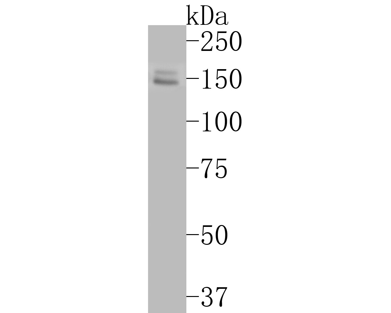 Western blot analysis of FYCO1 on SK-Br-3 cell lysates. Proteins were transferred to a PVDF membrane and blocked with 5% BSA in PBS for 1 hour at room temperature. The primary antibody (ER2001-04, 1/500) was used in 5% BSA at room temperature for 2 hours. Goat Anti-Rabbit IgG - HRP Secondary Antibody (HA1001) at 1:5,000 dilution was used for 1 hour at room temperature.