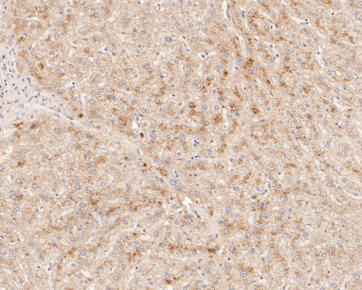Immunohistochemical analysis of paraffin-embedded human liver tissue using anti-FYCO1 antibody. The section was pre-treated using heat mediated antigen retrieval with Tris-EDTA buffer (pH 8.0-8.4) for 20 minutes.The tissues were blocked in 5% BSA for 30 minutes at room temperature, washed with ddH2O and PBS, and then probed with the primary antibody (ER2001-04, 1/500) for 30 minutes at room temperature. The detection was performed using an HRP conjugated compact polymer system. DAB was used as the chromogen. Tissues were counterstained with hematoxylin and mounted with DPX.