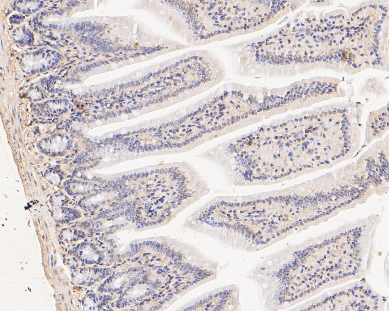Immunohistochemical analysis of paraffin-embedded mouse colon tissue using anti-FYCO1 antibody. The section was pre-treated using heat mediated antigen retrieval with Tris-EDTA buffer (pH 8.0-8.4) for 20 minutes.The tissues were blocked in 5% BSA for 30 minutes at room temperature, washed with ddH2O and PBS, and then probed with the primary antibody (ER2001-04, 1/500) for 30 minutes at room temperature. The detection was performed using an HRP conjugated compact polymer system. DAB was used as the chromogen. Tissues were counterstained with hematoxylin and mounted with DPX.