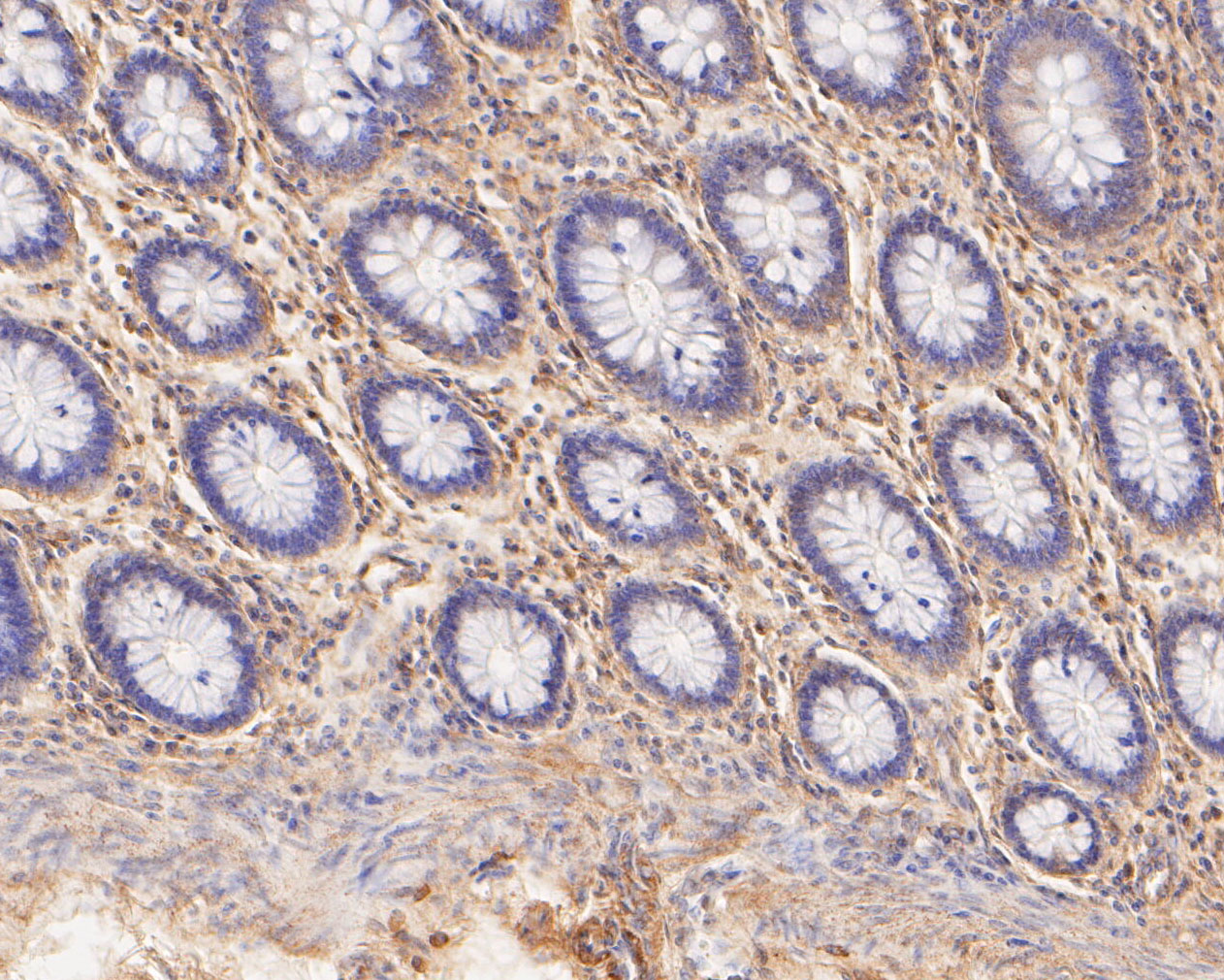 Immunohistochemical analysis of paraffin-embedded human colon tissue using anti-TREM2 antibody. The section was pre-treated using heat mediated antigen retrieval with Tris-EDTA buffer (pH 8.0-8.4) for 20 minutes.The tissues were blocked in 5% BSA for 30 minutes at room temperature, washed with ddH2O and PBS, and then probed with the primary antibody (ER2001-05, 1/50) for 30 minutes at room temperature. The detection was performed using an HRP conjugated compact polymer system. DAB was used as the chromogen. Tissues were counterstained with hematoxylin and mounted with DPX.
