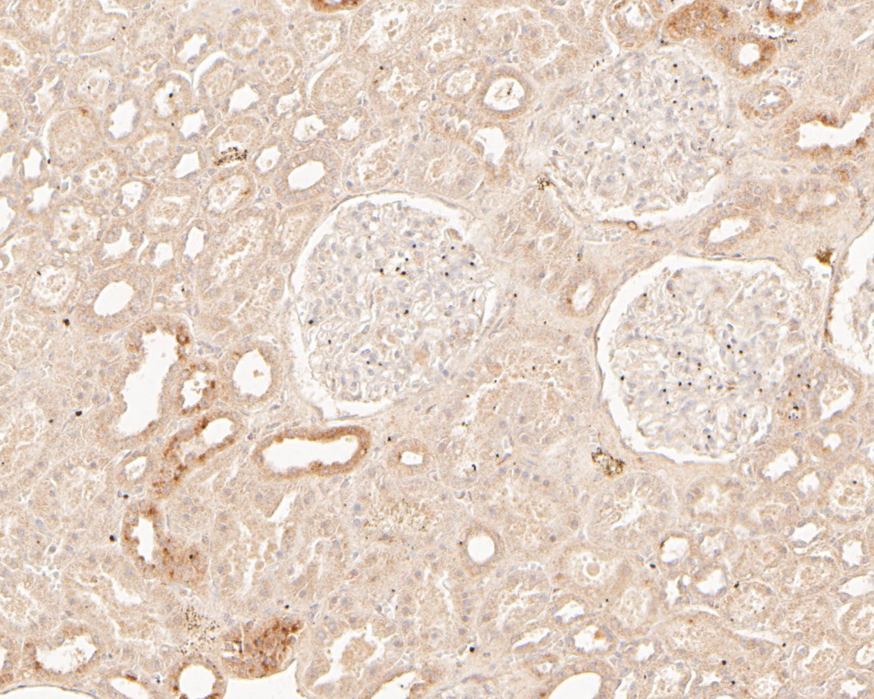 Immunohistochemical analysis of paraffin-embedded human kidney tissue using anti-TREM2 antibody. The section was pre-treated using heat mediated antigen retrieval with Tris-EDTA buffer (pH 8.0-8.4) for 20 minutes.The tissues were blocked in 5% BSA for 30 minutes at room temperature, washed with ddH2O and PBS, and then probed with the primary antibody (ER2001-05, 1/200) for 30 minutes at room temperature. The detection was performed using an HRP conjugated compact polymer system. DAB was used as the chromogen. Tissues were counterstained with hematoxylin and mounted with DPX.