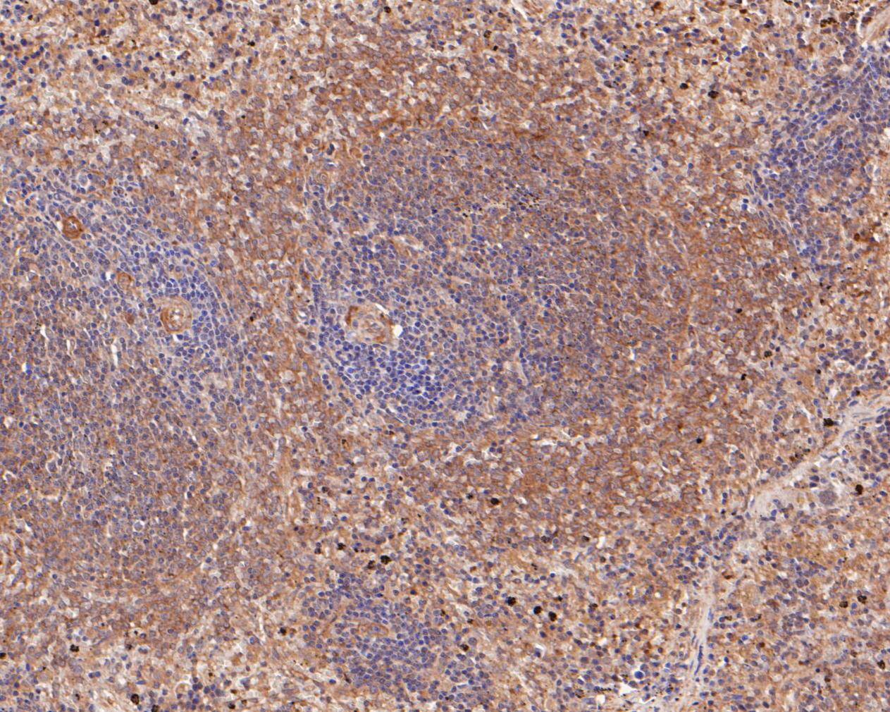 Immunohistochemical analysis of paraffin-embedded rat spleen tissue using anti-CD180 antibody. The section was pre-treated using heat mediated antigen retrieval with Tris-EDTA buffer (pH 8.0-8.4) for 20 minutes.The tissues were blocked in 5% BSA for 30 minutes at room temperature, washed with ddH2O and PBS, and then probed with the primary antibody (ER2001-06, 1/50) for 30 minutes at room temperature. The detection was performed using an HRP conjugated compact polymer system. DAB was used as the chromogen. Tissues were counterstained with hematoxylin and mounted with DPX.
