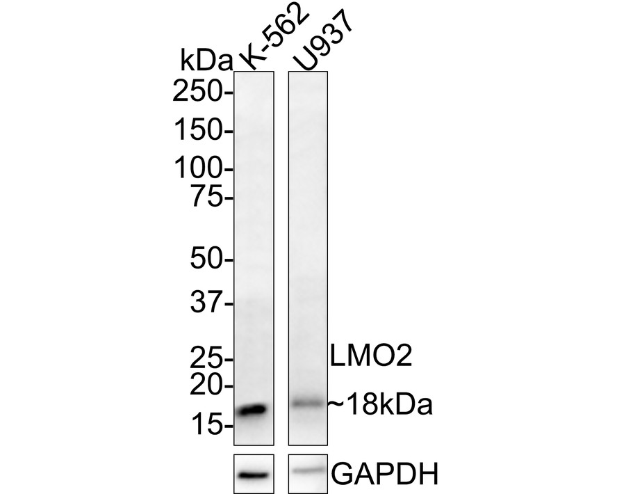 Western blot analysis of LMO2 on Daudi cell lysate. Proteins were transferred to a PVDF membrane and blocked with 5% BSA in PBS for 1 hour at room temperature. The primary antibody (ER2001-08, 1/1000) was used in 5% BSA at room temperature for 2 hours. Goat Anti-Rabbit IgG - HRP Secondary Antibody (HA1001) at 1:5,000 dilution was used for 1 hour at room temperature.