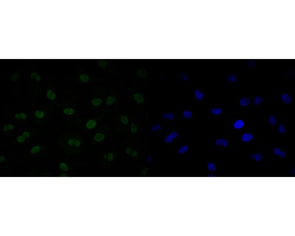 ICC staining of LMO2 in EA.hy926 cells (green). Formalin fixed cells were permeabilized with 0.1% Triton X-100 in TBS for 10 minutes at room temperature and blocked with 1% Blocker BSA for 15 minutes at room temperature. Cells were probed with the primary antibody (ER2001-08, 1/100) for 1 hour at room temperature, washed with PBS. Alexa Fluor®488 Goat anti-Rabbit IgG was used as the secondary antibody at 1/1,000 dilution. The nuclear counter stain is DAPI (blue).