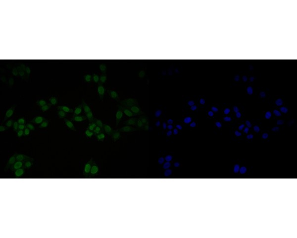 ICC staining of LMO2 in SW620 cells (green). Formalin fixed cells were permeabilized with 0.1% Triton X-100 in TBS for 10 minutes at room temperature and blocked with 1% Blocker BSA for 15 minutes at room temperature. Cells were probed with the primary antibody (ER2001-08, 1/50) for 1 hour at room temperature, washed with PBS. Alexa Fluor®488 Goat anti-Rabbit IgG was used as the secondary antibody at 1/1,000 dilution. The nuclear counter stain is DAPI (blue).